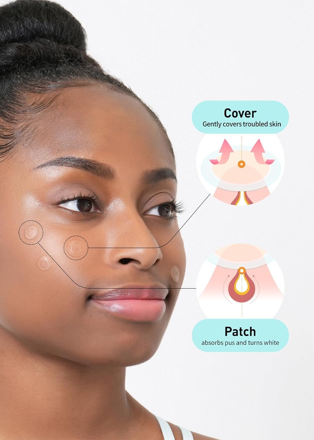 Korea Skincare Hydrocolloid Acne Pimple Blemishes Skin Trouble Spot Patch for Healing and Protecting 102 count 2size